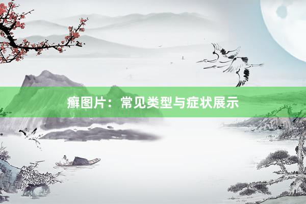 癣图片：常见类型与症状展示